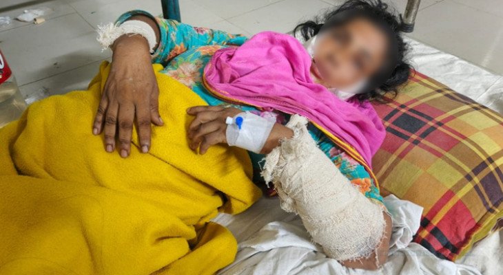 নওগাঁয় নারীকে এলোপাতাড়ি কুপিয়ে জখম, অভিযোগ বাবা-ছেলের বিরুদ্ধে